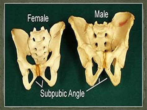 Sex Determination PPT
