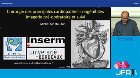 Chirurgie Des Principales Cardiopathies Cong Nitales Imagerie Pr