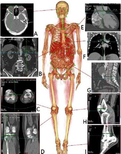 Examples Of Anatomical Landmarks In A CT Scan A Center Of The Right