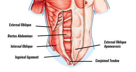 Inguinal Disruption Gilmores Groin Symptoms Causes Treatment