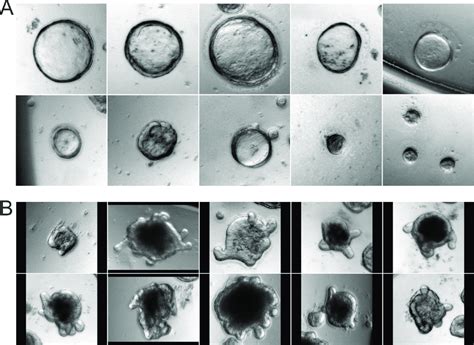 Colonospheres And Organoids With Crypts Budding Organoids At Day Of