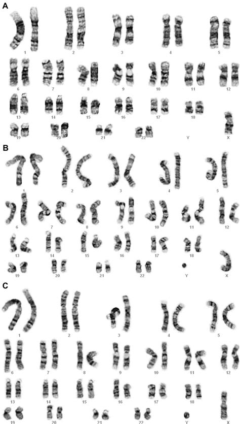 karyotype     karyotype  xry
