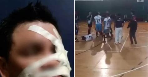 Otra grave agresión en el fútbol amateur argentino un jugador quedó inconsciente tras recibir