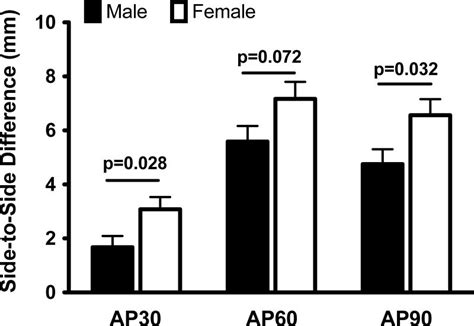 Sex Influences The Biomechanical Outcomes Of Anterior Cruciate Ligament Reconstruction In A Pre