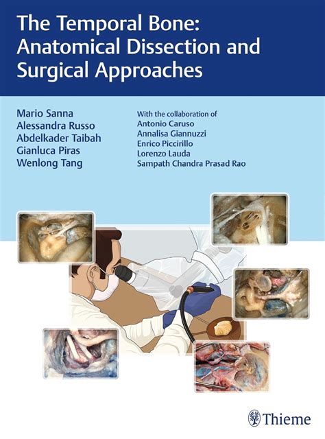 Temporal Bone Dissection Manual 10