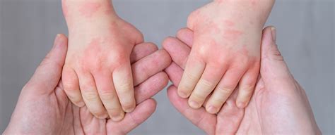 First Of Its Kind Treatment Shown To Have A Dramatic Effect On Kids
