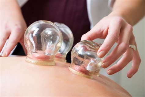 Cupping Therapy A Complete Guide Kanjo