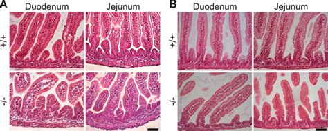 Jejunum Vs Ileum Histology