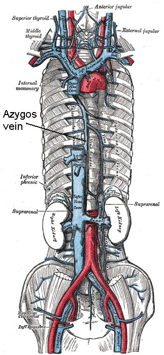 Azygos Vein Pacs