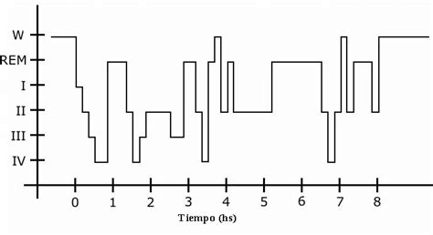 hypnogram  scientific diagram