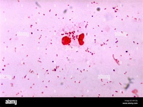 Neisseria Gonorrhoeae Microscope