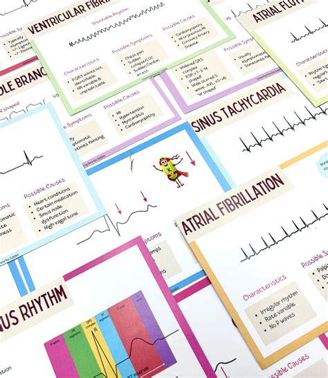 Ecg Flashcards Nurse Bec Supplies