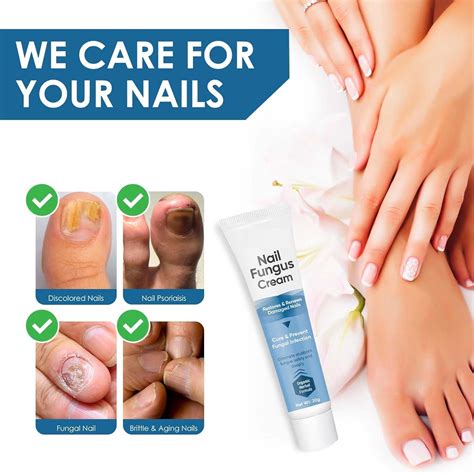 Nail Repair Cream Effective Toenail Fungal Treatment Maximum Strength