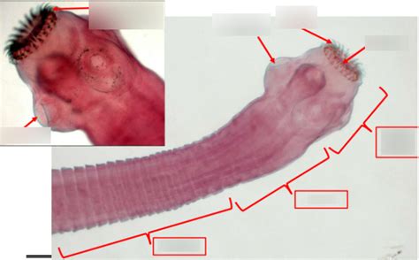 Diagram of Lab #3 - Dog tapeworm (Adult worm) | Quizlet