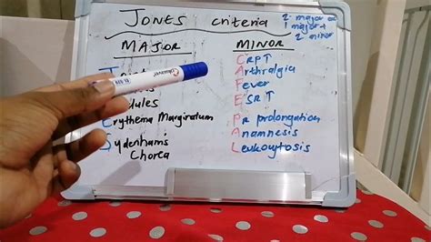 Mnemonic 23 Jones Criteria For Acute Rheumatic Fever Youtube