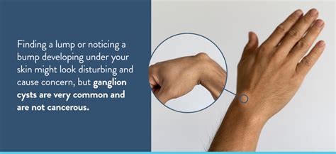 Common Hand and Wrist Conditions - Hand Center of Louisiana