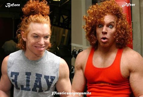 Carrot Top Before And After Body