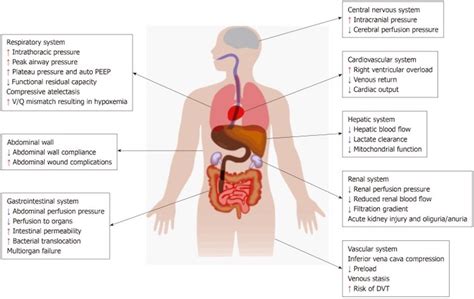 Abdominal Compartment Syndrome The Operative Review Of Surgery
