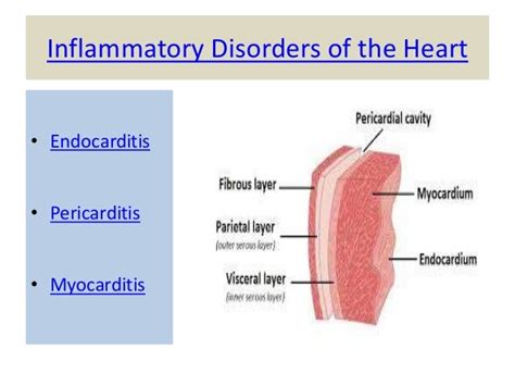myocarditis  pericarditis explained  home design ideas