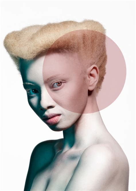 I M A Different Shade Of Normal South African Albino Lawyer Thando Hopa Turns Model To