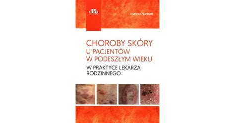 Choroby skóry u pacjentów w podeszłym wieku w praktyce lekarza