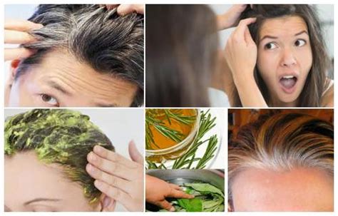 C Mo Eliminar Las Canas Naturalmente Tratamientos