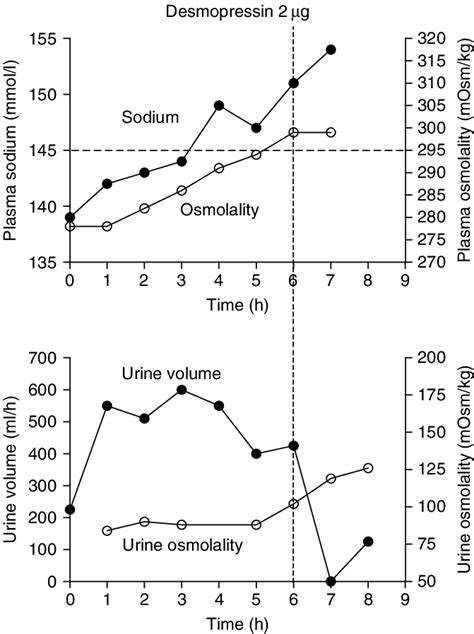 Results Of The Water Deprivation Test In The Mother The Vertical