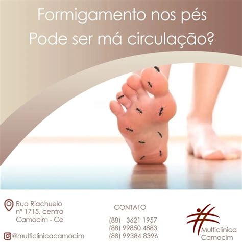 Pés Formigando O Que Pode Ser - CAMOCIM ONLINE: FORMIGAMENTO NOS PÉS PODE SER MÁ CIRCULAÇÃO?