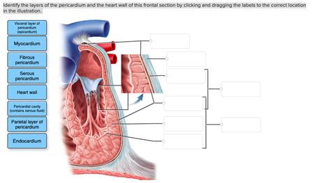 Solved Identify The Layers Of The Pericardium And The Heart