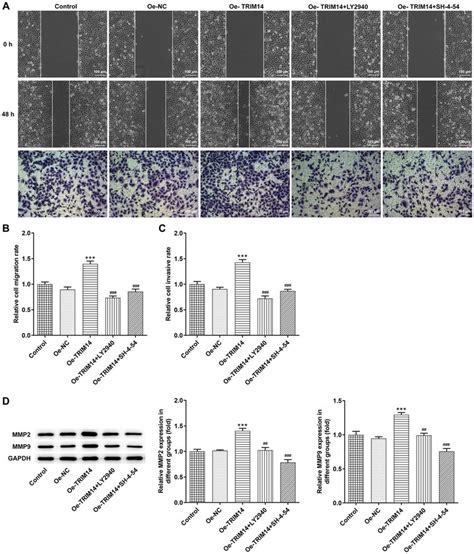 Trim14 Overexpression Enhanced Melanoma Cell Migration And Invasion