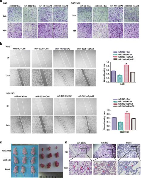 Overexpression Of Mir B Attenuates The Tumor Growth And Metastasis