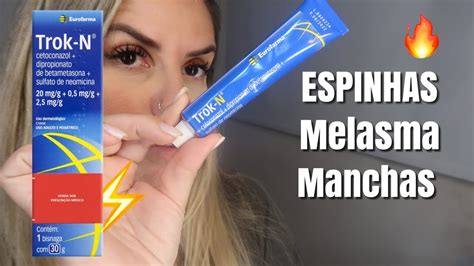 POMADA MILAGROSA PARA ESPINHAS MELASMA YouTube