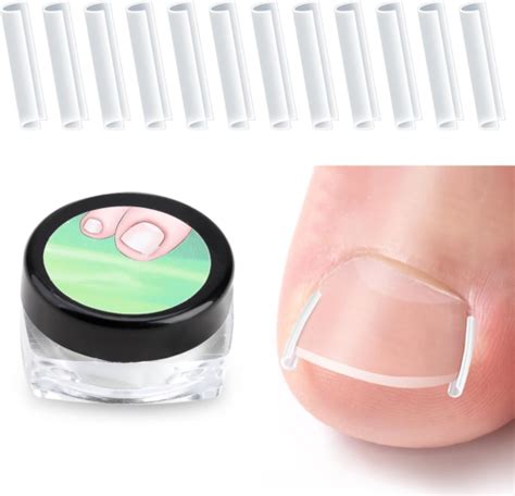 Pcs Ingrown Toenail Treatment Correction Strips Brace Kit Clear