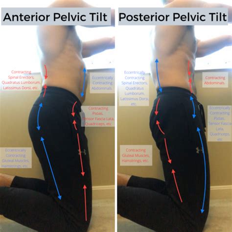 Anterior Pelvic Tilt How To Fix Your Asymmetries — Waugh Personal Training