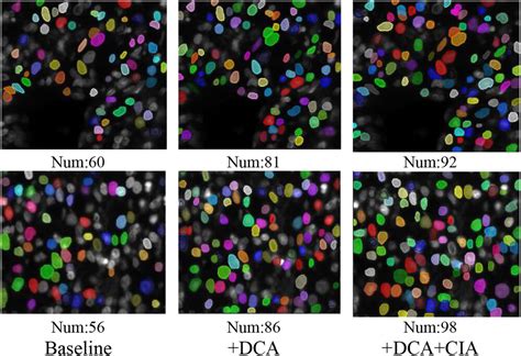 Improved Blendmask Nuclei Instance Segmentation For Medical Microscopy