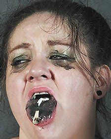 Burning Tits Cigarette Porn Pictures Xxx Photos Sex Images Pictoa