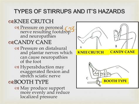 Lithotomy Position Abdullah