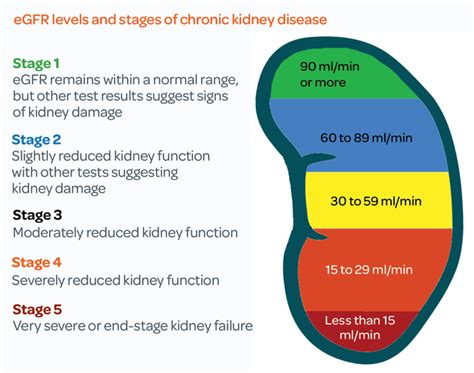 chronic kidney disease swan medical group