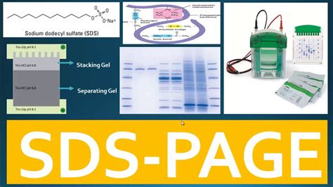 Sds Page Principle Of Sds Page And Use Of Buffer System For