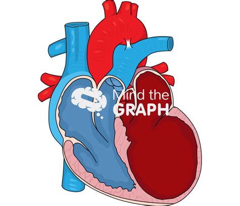 Left Ventricular Dilatation