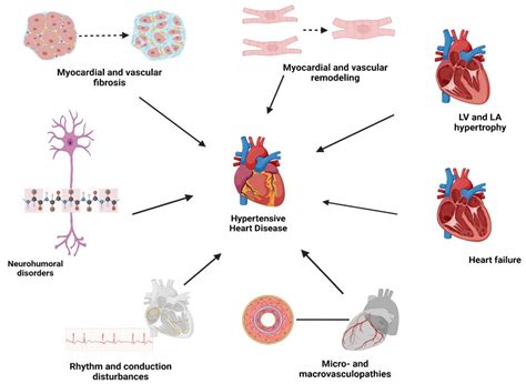 Hypertensive Heart Disease: A Narrative Review Series—Part 1
