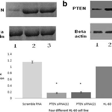 Expression Analysis Of Pten In Different Hl Cells A And B