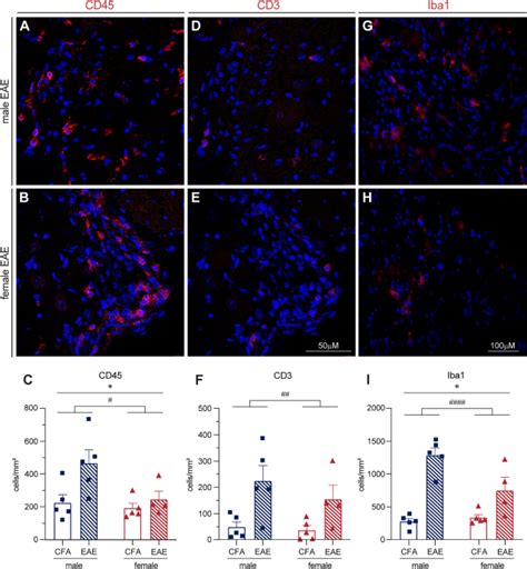 Sex Differences In The Inflammatory Response Of The Mouse Drg And Its Connection To Pain In