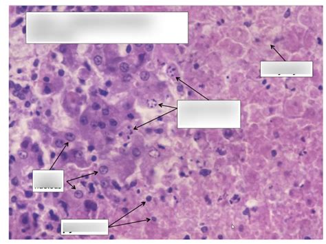 Cell injury and adaptation part 2 Diagram | Quizlet
