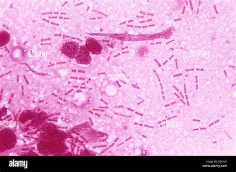 Bacillus Anthracis Gram Positive Patogenic Bacteria Agent Of Stock