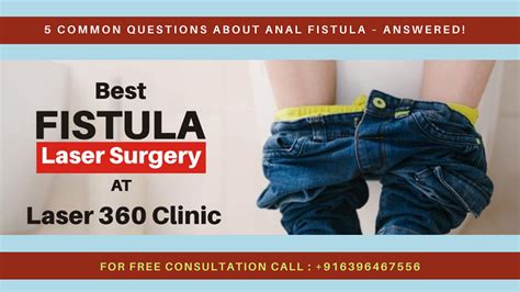 Common Questions About Anal Fistula Answered Laser Clinic