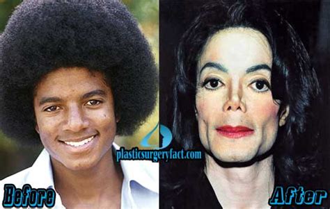 Michael Jackson Plastic Surgery Before And After Photos