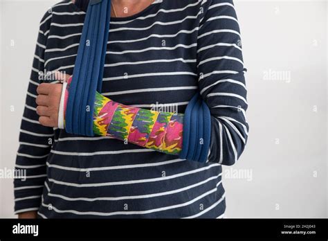 Broken Arm In Cast And Sling Stock Photo Alamy