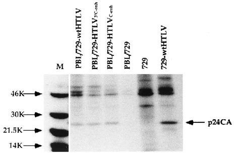 Immunoprecipitation Of 35 S Methionine Cysteine Labeled Primary Tcell