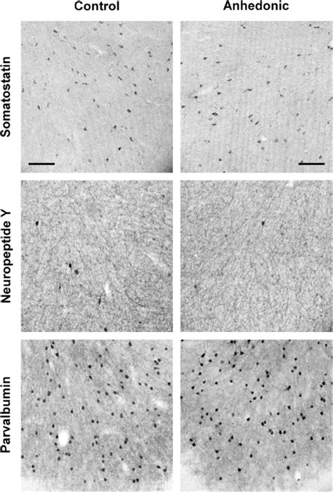 Representative photomicrographs of the different subtypes of GABAergic ...